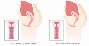 الجراحات التجميلية